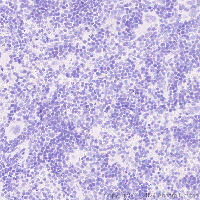 Immunohistochemistry (Formalin/PFA-fixed paraffin-embedded sections) - Anti-ATP6V0D2 antibody [EPR29173-521] - BSA and Azide free (AB321810)