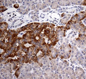 Immunohistochemistry (Formalin/PFA-fixed paraffin-embedded sections) - Anti-ATP6V0D2 antibody [OTI2D6] (AB236375)