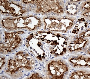 Immunohistochemistry (Formalin/PFA-fixed paraffin-embedded sections) - Anti-ATP6V0D2 antibody [OTI2D6] (AB236375)