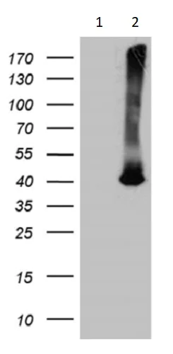 Western blot - Anti-ATP6V0D2 antibody [OTI2D6] (AB236375)