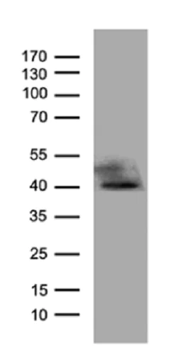 Western blot - Anti-ATP6V0D2 antibody [OTI2D6] (AB236375)