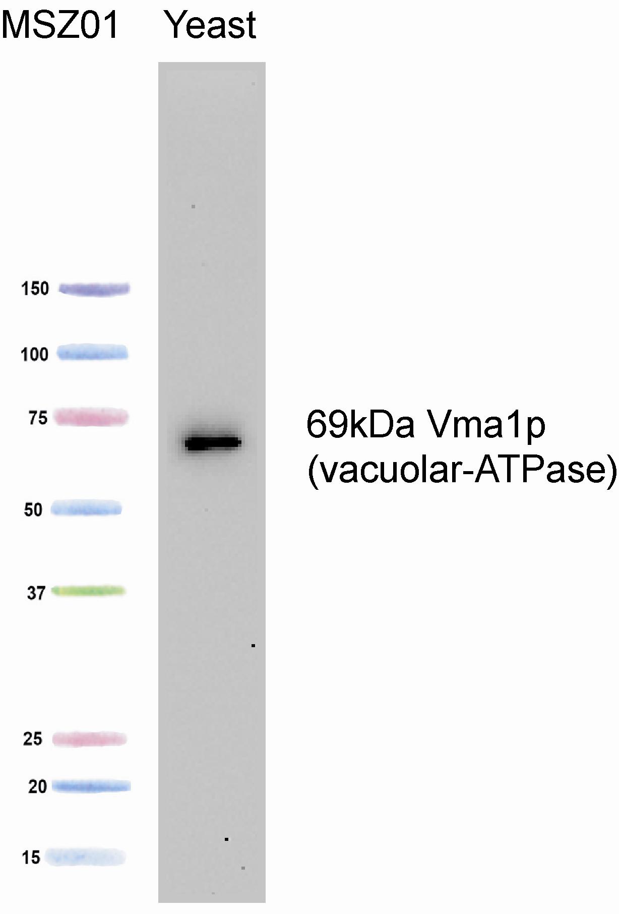 Western blot - Anti-ATP6V1A antibody [8B1F3] (AB113745), expandable thumbnail