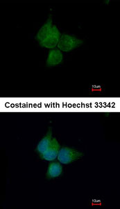 Immunocytochemistry/ Immunofluorescence - Anti-ATP6V1A antibody (AB137574), expandable thumbnail