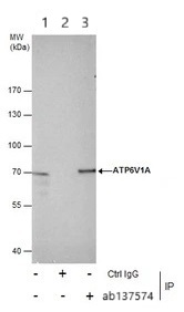 Immunoprecipitation - Anti-ATP6V1A antibody (AB137574)