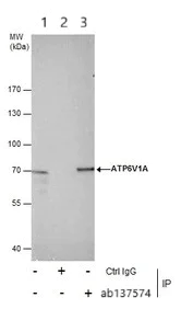 Immunoprecipitation - Anti-ATP6V1A antibody (AB137574)