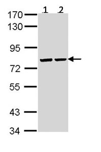 Western blot - Anti-ATP6V1A antibody (AB137574), expandable thumbnail