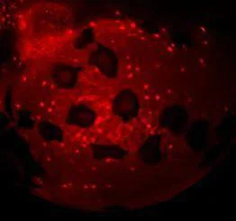 IHC - Wholemount - Anti-ATP6V1A antibody (AB209823)