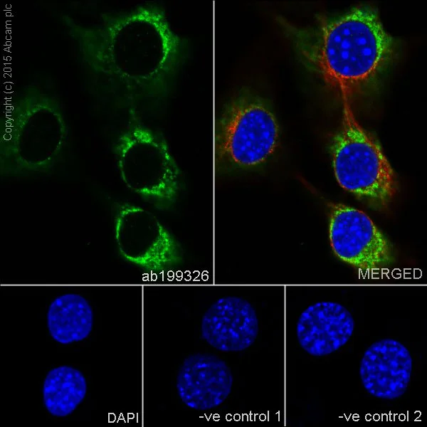 Immunocytochemistry/ Immunofluorescence - Anti-ATP6V1A antibody [EPR19270] (AB199326)