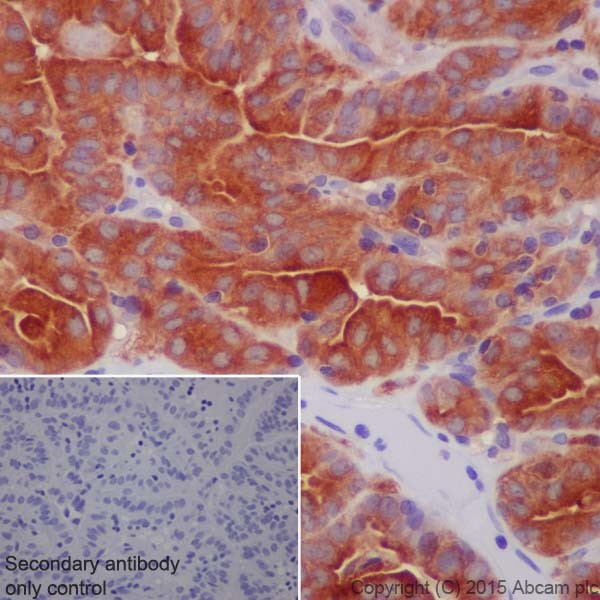 Immunohistochemistry (Formalin/PFA-fixed paraffin-embedded sections) - Anti-ATP6V1A antibody [EPR19270] (AB199326), expandable thumbnail