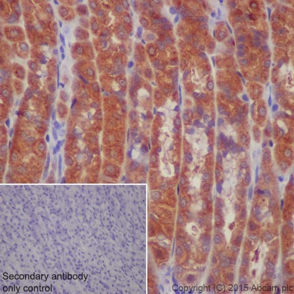 Immunohistochemistry (Formalin/PFA-fixed paraffin-embedded sections) - Anti-ATP6V1A antibody [EPR19270] (ab199326), expandable thumbnail