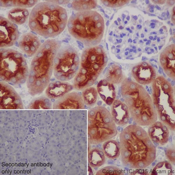 Immunohistochemistry (Formalin/PFA-fixed paraffin-embedded sections) - Anti-ATP6V1A antibody [EPR19270] (ab199326), expandable thumbnail