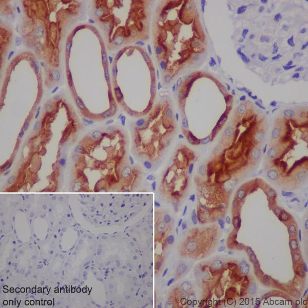 Immunohistochemistry (Formalin/PFA-fixed paraffin-embedded sections) - Anti-ATP6V1A antibody [EPR19270] (AB199326), expandable thumbnail