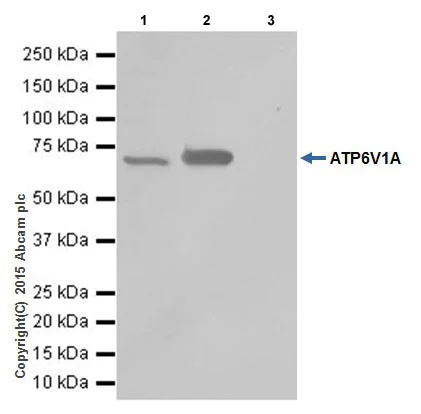 Immunoprecipitation - Anti-ATP6V1A antibody [EPR19270] (AB199326)