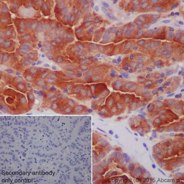 Immunohistochemistry (Formalin/PFA-fixed paraffin-embedded sections) - Anti-ATP6V1A antibody [EPR19270] - BSA and Azide free (AB251267)