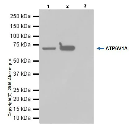 Immunoprecipitation - Anti-ATP6V1A antibody [EPR19270] - BSA and Azide free (AB251267)