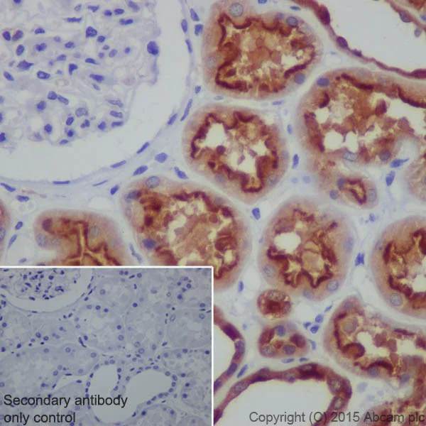 Immunohistochemistry (Formalin/PFA-fixed paraffin-embedded sections) - Anti-ATP6V1A antibody [EPR19271] (AB199325)