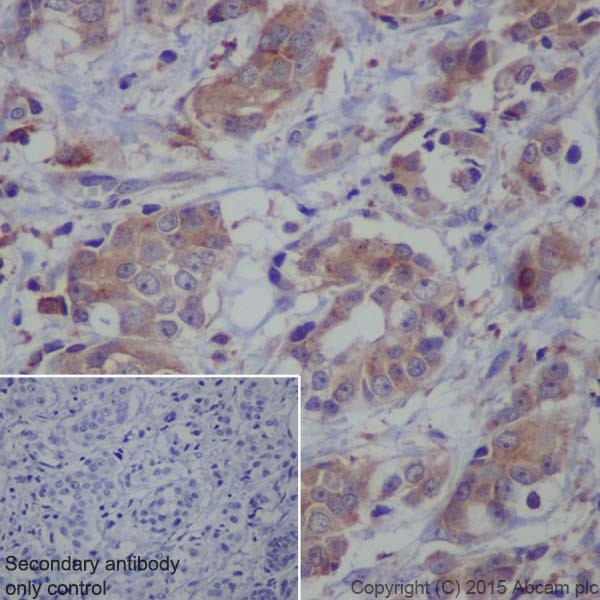 Immunohistochemistry (Formalin/PFA-fixed paraffin-embedded sections) - Anti-ATP6V1A antibody [EPR19271] (AB199325)
