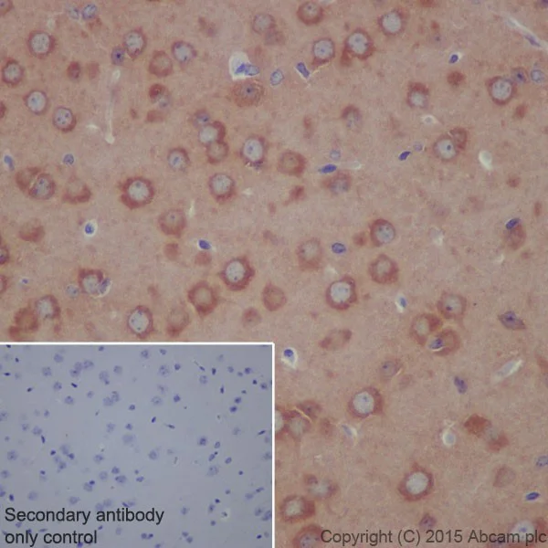 Immunohistochemistry (Formalin/PFA-fixed paraffin-embedded sections) - Anti-ATP6V1A antibody [EPR19271] (AB199325)