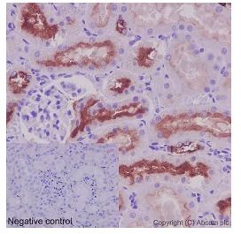 Immunohistochemistry (Formalin/PFA-fixed paraffin-embedded sections) - Anti-ATP6V1B1 antibody [EPR16400] (AB192612)