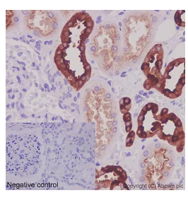 Immunohistochemistry (Formalin/PFA-fixed paraffin-embedded sections) - Anti-ATP6V1B1 antibody [EPR16400] (AB192612)