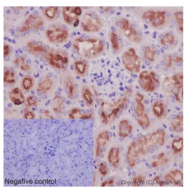 Immunohistochemistry (Formalin/PFA-fixed paraffin-embedded sections) - Anti-ATP6V1B1 antibody [EPR16400] (AB192612)