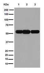 Western blot - Anti-ATP6V1B1 antibody [EPR16400] (AB192612)