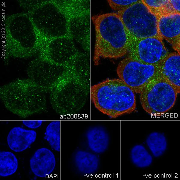 Immunocytochemistry/ Immunofluorescence - Anti-ATP6V1B1 + ATP6V1B2 antibody [EPR16401] (AB200839)