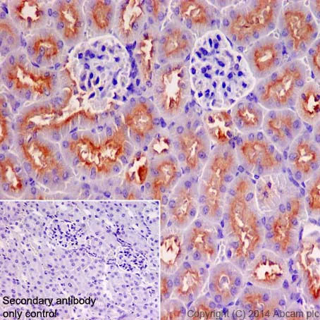 Immunohistochemistry (Formalin/PFA-fixed paraffin-embedded sections) - Anti-ATP6V1B1 + ATP6V1B2 antibody [EPR16401] (AB200839)