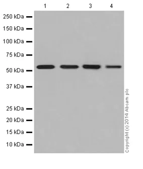 Western blot - Anti-ATP6V1B1 + ATP6V1B2 antibody [EPR16401] (AB200839)