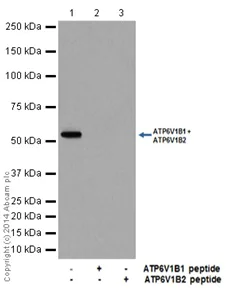 Western blot - Anti-ATP6V1B1 + ATP6V1B2 antibody [EPR16401] (AB200839)