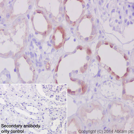 Immunohistochemistry (Formalin/PFA-fixed paraffin-embedded sections) - Anti-ATP6V1B1 + ATP6V1B2 antibody [EPR16401] - BSA and Azide free (AB243945)