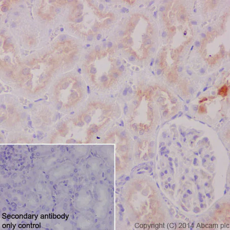 Immunohistochemistry (Formalin/PFA-fixed paraffin-embedded sections) - Anti-ATP6V1B1 + ATP6V1B2 antibody [EPR16401] - BSA and Azide free (AB243945)