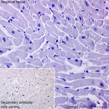 Immunohistochemistry (Formalin/PFA-fixed paraffin-embedded sections) - Anti-ATP6V1B1 + ATP6V1B2 antibody [EPR16401] - BSA and Azide free (AB243945)