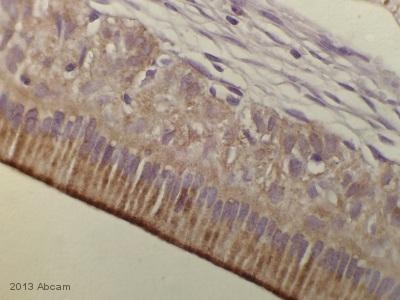 Immunohistochemistry (Formalin/PFA-fixed paraffin-embedded sections) - Anti-ATP6V1B2 antibody (AB73404), expandable thumbnail