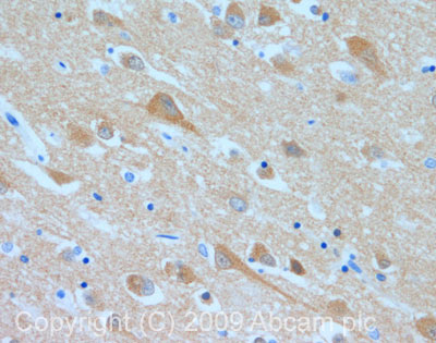 Immunohistochemistry (Formalin/PFA-fixed paraffin-embedded sections) - Anti-ATP6V1B2 antibody (AB73404), expandable thumbnail