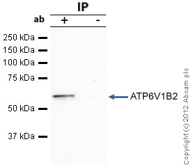 Immunoprecipitation - Anti-ATP6V1B2 antibody (AB73404), expandable thumbnail