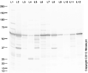 Western blot - Anti-ATP6V1B2 antibody (AB73404), expandable thumbnail