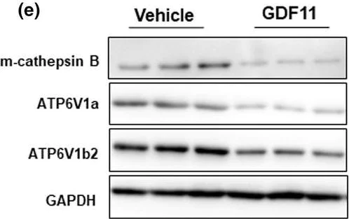 Western blot - Anti-ATP6V1B2 antibody (AB73404)