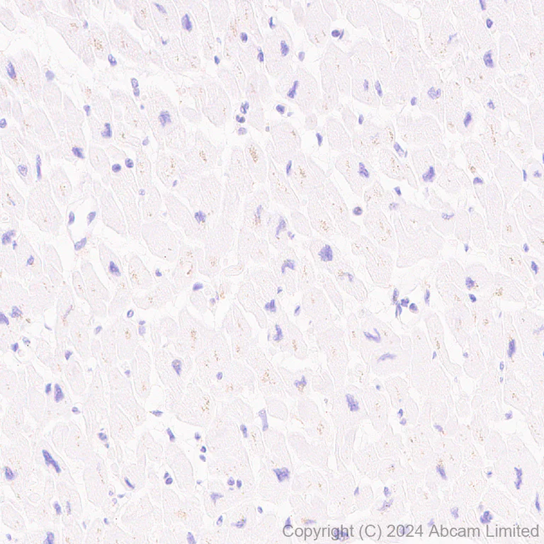 Immunohistochemistry (Formalin/PFA-fixed paraffin-embedded sections) - Anti-ATP6V1B2 antibody [EPR28916-13] (AB322055)