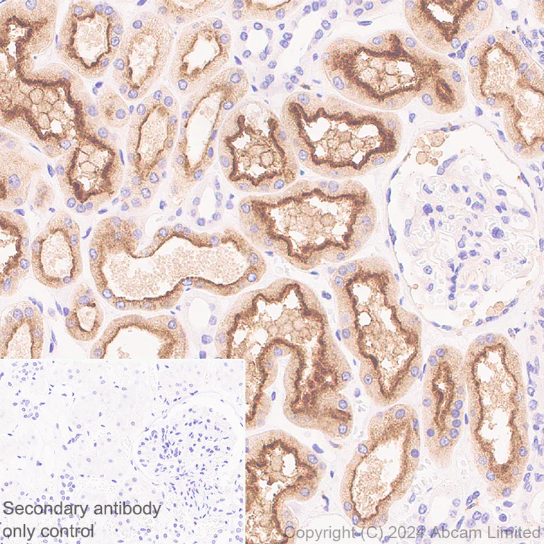 Immunohistochemistry (Formalin/PFA-fixed paraffin-embedded sections) - Anti-ATP6V1B2 antibody [EPR28916-13] (AB322055)