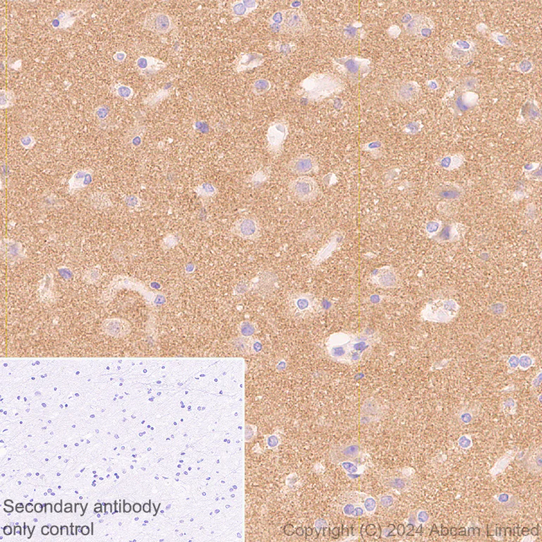 Immunohistochemistry (Formalin/PFA-fixed paraffin-embedded sections) - Anti-ATP6V1B2 antibody [EPR28916-13] (AB322055)