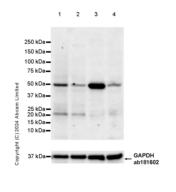 Western blot - Anti-ATP6V1B2 antibody [EPR28916-13] (AB322055)