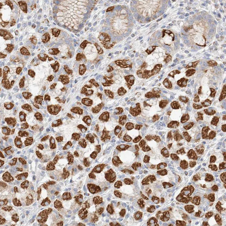 Immunohistochemistry (Formalin/PFA-fixed paraffin-embedded sections) - Anti-ATP6V1C1 antibody (AB272594)