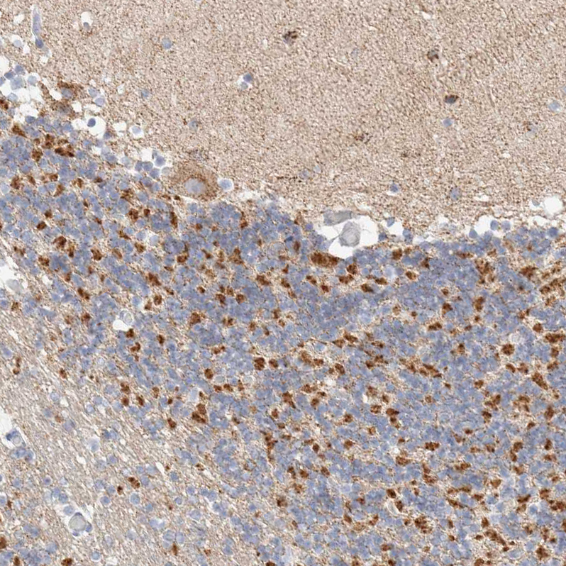 Immunohistochemistry (Formalin/PFA-fixed paraffin-embedded sections) - Anti-ATP6V1C1 antibody (AB272594), expandable thumbnail