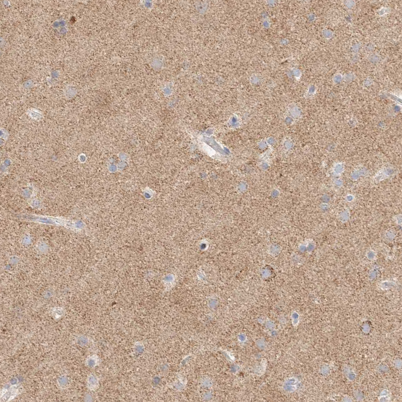 Immunohistochemistry (Formalin/PFA-fixed paraffin-embedded sections) - Anti-ATP6V1C1 antibody (AB272594), expandable thumbnail