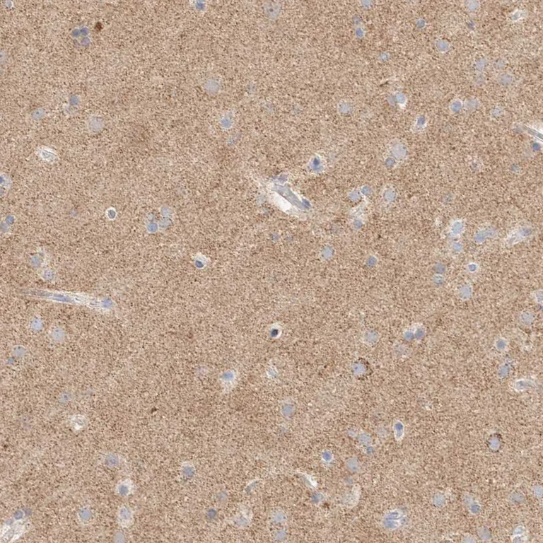 Immunohistochemistry (Formalin/PFA-fixed paraffin-embedded sections) - Anti-ATP6V1C1 antibody (AB272594)