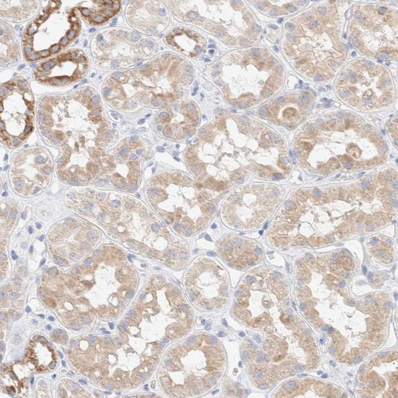 Immunohistochemistry (Formalin/PFA-fixed paraffin-embedded sections) - Anti-ATP6V1C1 antibody (AB272594), expandable thumbnail