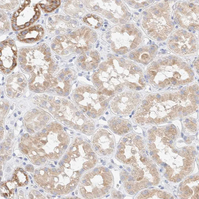 Immunohistochemistry (Formalin/PFA-fixed paraffin-embedded sections) - Anti-ATP6V1C1 antibody (AB272594)