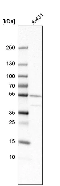 Western blot - Anti-ATP6V1C1 antibody (AB272594)
