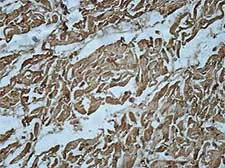 Immunohistochemistry (Formalin/PFA-fixed paraffin-embedded sections) - Anti-ATP6V1C2 antibody (AB176771)